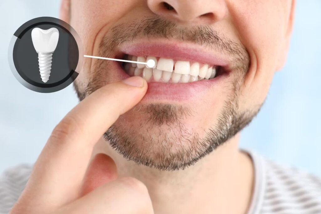 Divine Family Dental | Orthodontics for Adults in Milwaukee: Clear Aligners vs. Braces and How To Decide